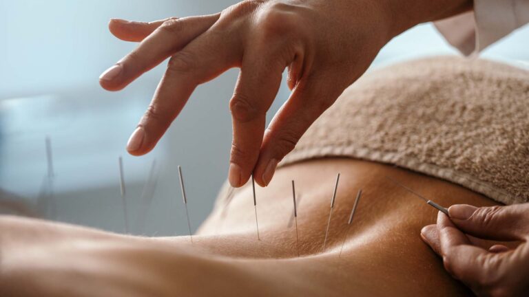 ¿Qué es la acupuntura?